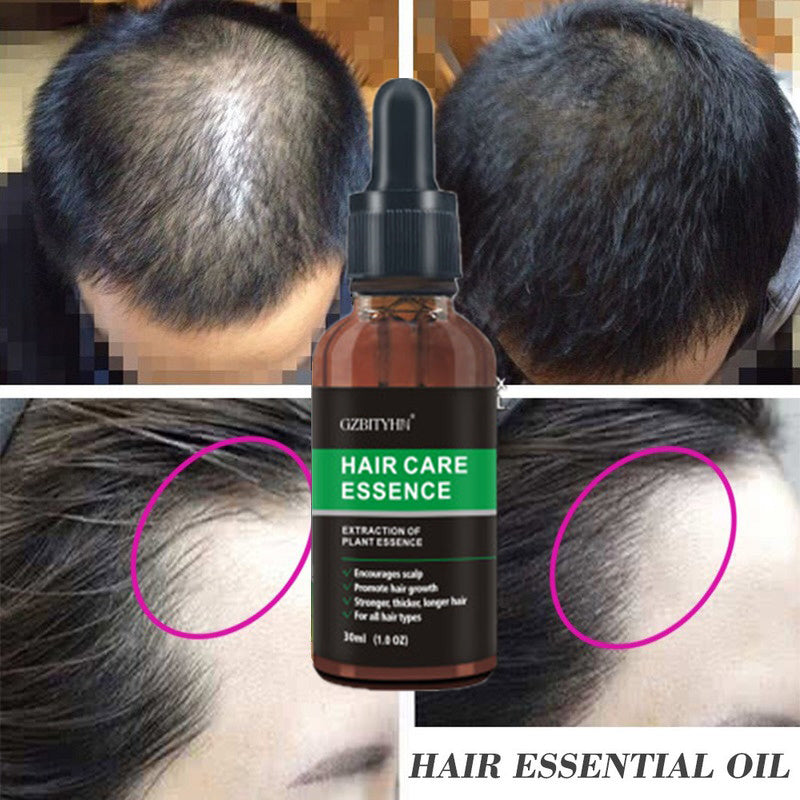 Hair Growth Oil Hair Growth Oil Oem Hair Care Essential Oil.