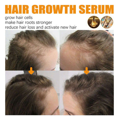 Hair Growth Repair Care Essential Oil.